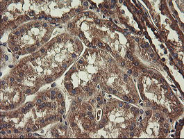 m07059 anti ubc6e ube2j1 mouse monoclonal antibody clone id oti3d1 ihc testing 15