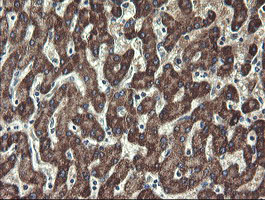 m07059 anti ubc6e ube2j1 mouse monoclonal antibody clone id oti3d1 ihc testing 16
