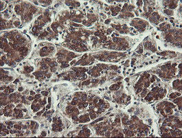 m07059 anti ubc6e ube2j1 mouse monoclonal antibody clone id oti3d1 ihc testing 17