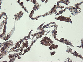 m07059 anti ubc6e ube2j1 mouse monoclonal antibody clone id oti3d1 ihc testing 18