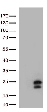 HEK293T cells were transfected with the pCMV6-ENTRY control (Left lane) or pCMV6-ENTRY IFNL1 (Right lane) cDNA for 48 hrs and lysed