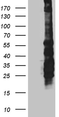 HEK293T cells were transfected with the pCMV6-ENTRY control (Left lane) or pCMV6-ENTRY SPAG5 (Right lane) cDNA for 48 hrs and lysed