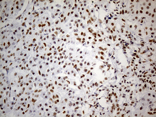 Immunohistochemical staining of paraffin-embedded Human pancreas tissue within the normal limits using anti-GABPB1 mouse monoclonal antibody