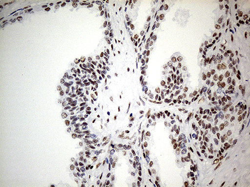m07070 anti gabpb2 gabpb1 mouse monoclonal antibody clone id oti7a7 ihc testing 4