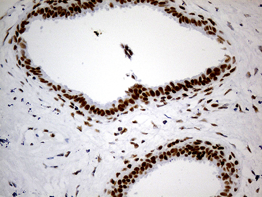 m07070 anti gabpb2 gabpb1 mouse monoclonal antibody clone id oti7a7 ihc testing 5