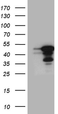 HEK293T cells were transfected with the pCMV6-ENTRY control (Left lane) or pCMV6-ENTRY GABPB1 (Right lane) cDNA for 48 hrs and lysed