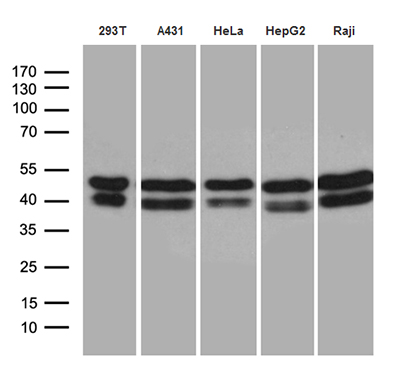 Western blot analysis of extracts (35ug) from 5 different cell lines by using anti-GABPB1 monoclonal antibody (1:500)