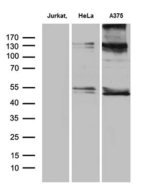 m07073 1 anti ikb epsilon nfkbie mouse monoclonal antibody clone id oti6h8 wb testing 2