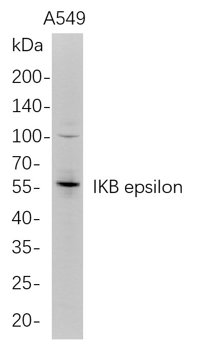 Western Blot analysis of A549 whole cell lysates were separated by 4-20% SDS-PAGE, and the membrane was blotted with anti-IKB epsilon rabbit mAb