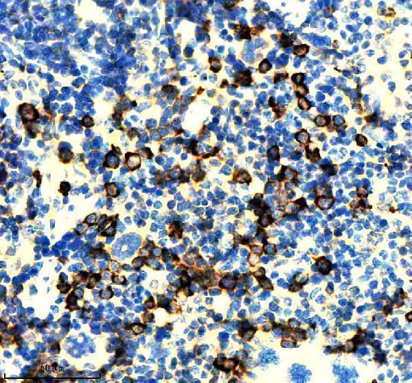 m07073 nfkbie primary antibodies ihc testing 1_1