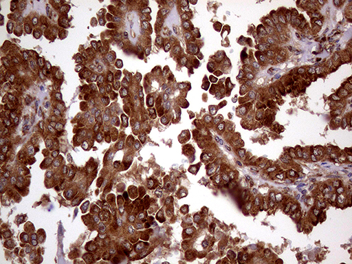m07074 anti rrbp1 mouse monoclonal antibody clone id oti3f1 ihc testing 3