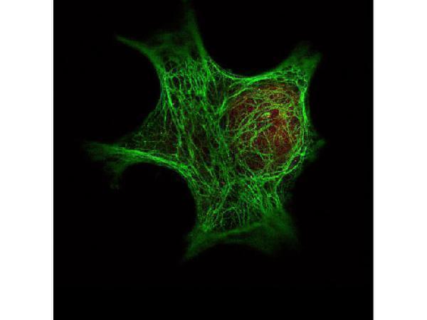 m07078 krt6c primary antibodies if testing 1