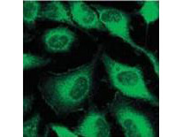 m07078 krt6c primary antibodies if testing 3