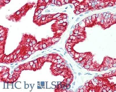 m07078 krt6c primary antibodies ihc testing 4