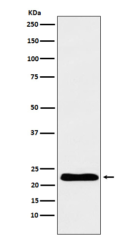 Western blot analysis of TNNI1 expression in Human fetal heart lysate