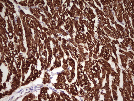Immunohistochemical staining of paraffin-embedded Human adult heart tissue using anti-TNNI1 mouse monoclonal antibody