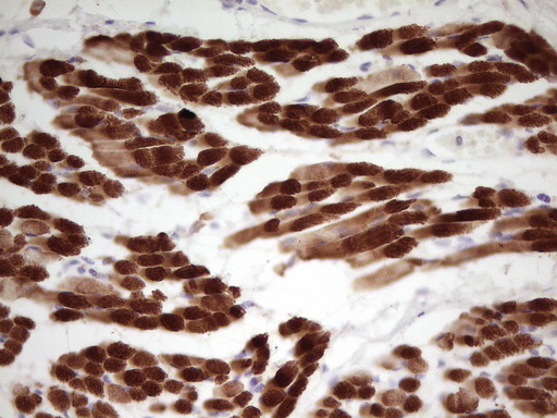 Immunohistochemical staining of paraffin-embedded Human muscle tissue using anti-TNNI1 mouse monoclonal antibody