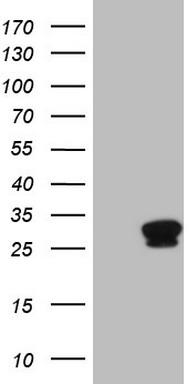HEK293T cells were transfected with the pCMV6-ENTRY control (Left lane) or pCMV6-ENTRY TNNI1 (Right lane) cDNA for 48 hrs and lysed
