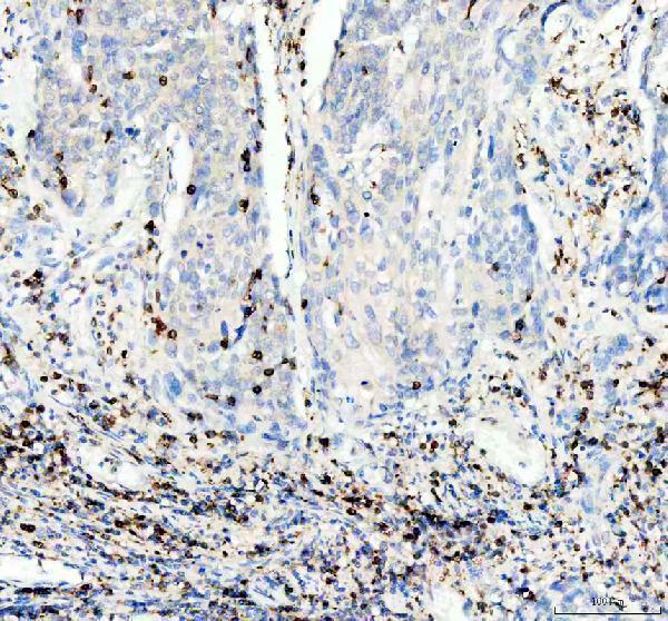 IHC analysis of ITGAE using anti-ITGAE antibody (M07091)