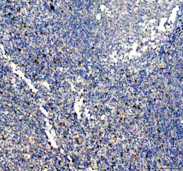 IHC analysis of ITGAE using anti-ITGAE antibody (M07091)