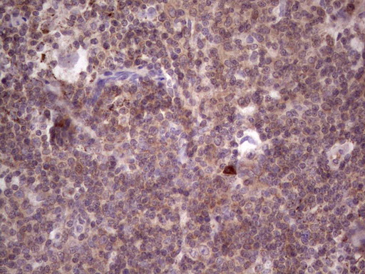 m07092 anti pkc nu prkd3 mouse monoclonal antibody clone id oti3d8 ihc testing 2