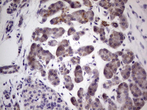 m07092 anti pkc nu prkd3 mouse monoclonal antibody clone id oti3d8 ihc testing 3