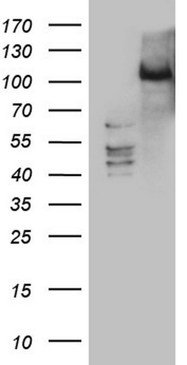 m07092 anti pkc nu prkd3 mouse monoclonal antibody clone id oti3d8 wb testing 1