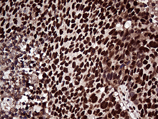m07103 anti zranb2 mouse monoclonal antibody clone id oti2e3 ihc testing 2