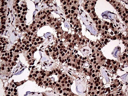 m07103 anti zranb2 mouse monoclonal antibody clone id oti2e3 ihc testing 3