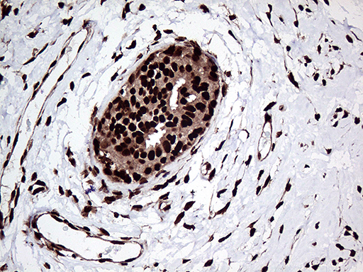 m07103 anti zranb2 mouse monoclonal antibody clone id oti2e3 ihc testing 4