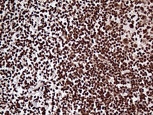 m07103 anti zranb2 mouse monoclonal antibody clone id oti2e3 ihc testing 6