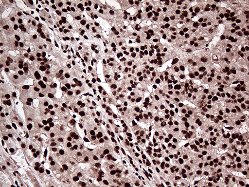 m07103 anti zranb2 mouse monoclonal antibody clone id oti2e3 ihc testing 7
