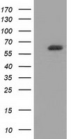 HEK293T cells were transfected with the pCMV6-ENTRY control (Left lane) or pCMV6-ENTRY GBP5 (Right lane) cDNA for 48 hrs and lysed