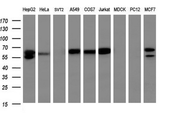 Western blot analysis of extracts (35ug) from 9 different cell lines by using anti-GBP5 monoclonal antibody