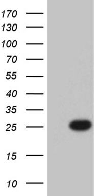 HEK293T cells were transfected with the pCMV6-ENTRY control (Left lane) or pCMV6-ENTRY BCAS2 (Right lane) cDNA for 48 hrs and lysed