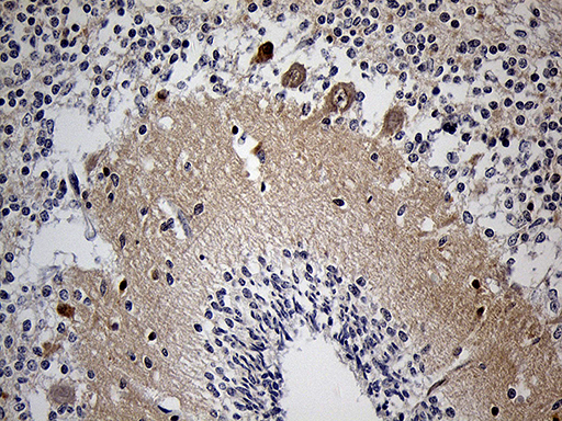 Immunohistochemical staining of paraffin-embedded Human embryonic cerebellum within the normal limits using anti-KLC2 mouse monoclonal antibody. (Heat-induced epitope retrieval by 1mM EDTA in 10mM Tris buffer (pH8.5) at 120°C for 3min