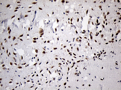 Immunohistochemical staining of paraffin-embedded Human adult brain tissue within the normal limits using anti-DLX1 mouse monoclonal antibody. (Heat-induced epitope retrieval by 1mM EDTA in 10mM Tris buffer (pH8.5) at 120°C for 3min
