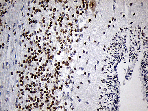 Immunohistochemical staining of paraffin-embedded Human embryonic cerebellum within the normal limits using anti-DLX1 mouse monoclonal antibody. (Heat-induced epitope retrieval by 1mM EDTA in 10mM Tris buffer (pH8.5) at 120°C for 3min