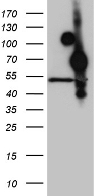 m07128 anti hoxa3 mouse monoclonal antibody clone id oti8c5 wb testing 1