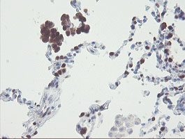 m07130 anti rbpms mouse monoclonal antibody clone id oti3b7 ihc testing 10