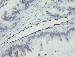 m07130 anti rbpms mouse monoclonal antibody clone id oti3b7 ihc testing 3