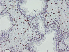 m07130 anti rbpms mouse monoclonal antibody clone id oti3b7 ihc testing 6