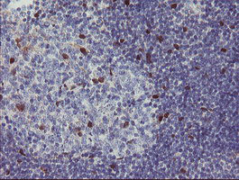 m07130 anti rbpms mouse monoclonal antibody clone id oti3b7 ihc testing 7