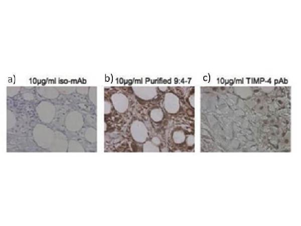 m07131 timp4 primary antibodies ihc testing 1