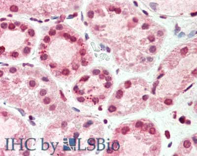 m07131 timp4 primary antibodies ihc testing 3