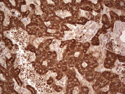 Immunohistochemical staining of paraffin-embedded Human liver tissue within the normal limits using anti-ABAT mouse monoclonal antibody