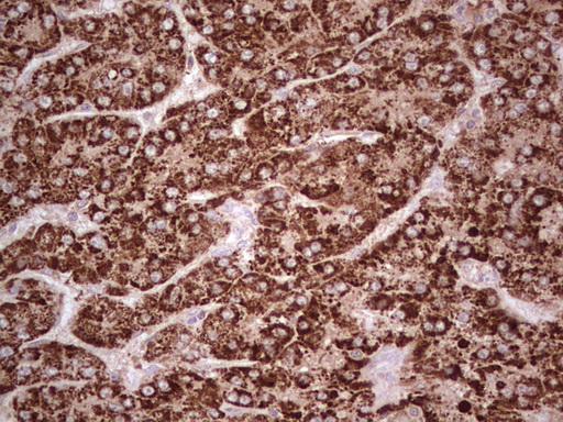 m07133 1 anti abat mouse monoclonal antibody clone id oti6c9 ihc testing 4