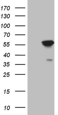 HEK293T cells were transfected with the pCMV6-ENTRY control (Left lane) or pCMV6-ENTRY ABAT (Right lane) cDNA for 48 hrs and lysed