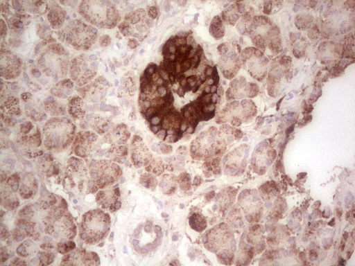 m07133 anti abat mouse monoclonal antibody clone id oti7h1 ihc testing 2