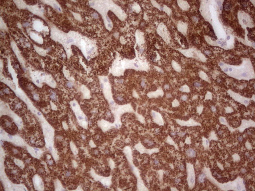 m07133 anti abat mouse monoclonal antibody clone id oti7h1 ihc testing 3